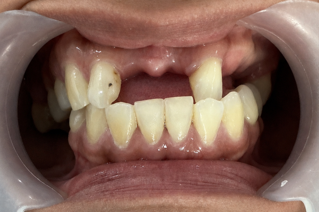 Before smile makeover