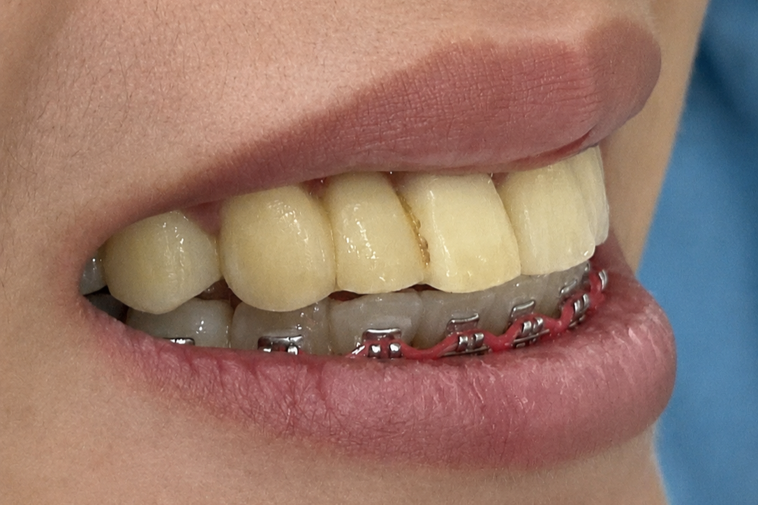 Before smile makeover